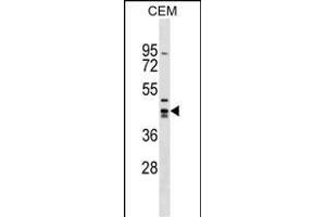 ZN Antibody (Center) (ABIN1538101 and ABIN2849088) western blot analysis in CEM cell line lysates (35 μg/lane). (Zinc Finger and SCAN Domain Containing 9 (ZSCAN9) (AA 217-243) Antikörper)