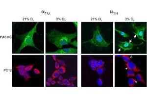 Upregulation of CACNA1H under hypoxia.