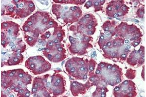 Human Pancreas: Formalin-Fixed, Paraffin-Embedded (FFPE) (GBAS Antikörper  (Internal Region))