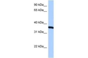 Western Blotting (WB) image for anti-Ribosomal Protein, Large, P0 (RPLP0) antibody (ABIN2462058) (RPLP0 Antikörper)