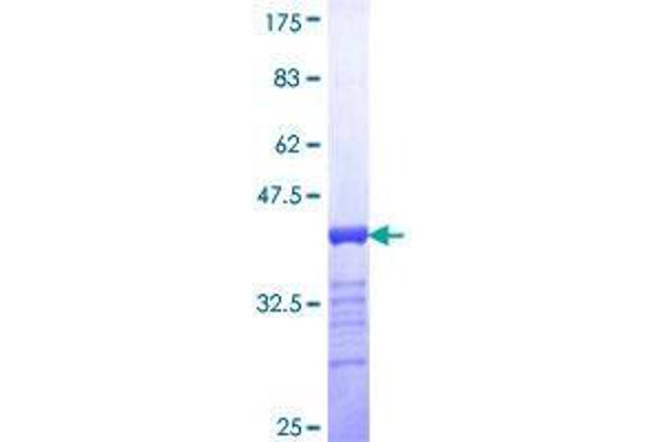 SALL4 Protein (AA 954-1053) (GST tag)