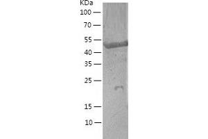 Western Blotting (WB) image for Angiopoietin-Like 2 (ANGPTL2) (AA 23-493) protein (His tag) (ABIN7121831) (ANGPTL2 Protein (AA 23-493) (His tag))