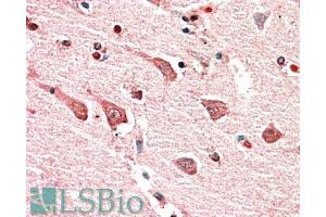 ABIN870635 (5µg/ml) staining of paraffin embedded Human Cerebral Cortex. (Myosin IB Antikörper  (Internal Region))