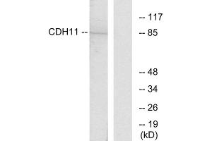Western blot analysis of extracts from Jurkat cells, using CDH11 antibody. (OB Cadherin Antikörper  (Internal Region))