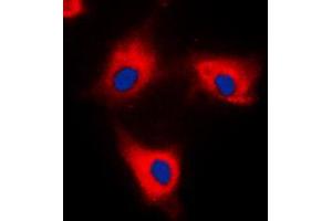 Immunofluorescent analysis of 14-3-3 theta/tau staining in HeLa cells. (14-3-3 theta Antikörper  (C-Term))
