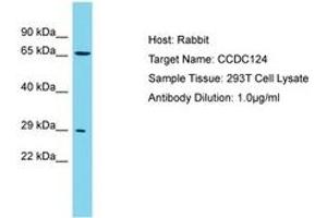Image no. 1 for anti-Coiled-Coil Domain Containing 124 (CCDC124) (AA 46-95) antibody (ABIN6750742) (CCDC124 Antikörper  (AA 46-95))