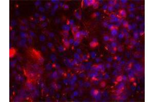 Immunofluorescence (IF) image for anti-Intercellular Adhesion Molecule 1 (ICAM1) antibody (ABIN2664766) (ICAM1 Antikörper)