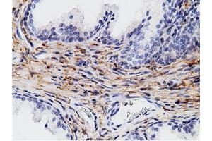 Immunohistochemical staining of paraffin-embedded Human liver tissue using anti-CD80 mouse monoclonal antibody. (CD80 Antikörper)