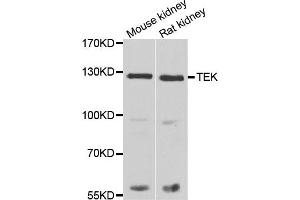 Western blot analysis of extracts of various tissues, using TEK antibody (TEK Antikörper)