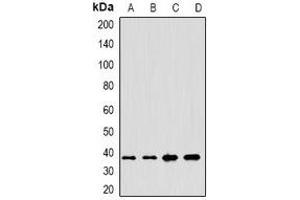 Western blot analysis of Anamorsin expression in HepG2 (A), Hela (B), MCF7 (C), mouse testis (D) whole cell lysates. (CIAPIN1 Antikörper)