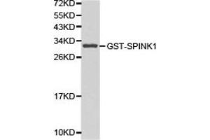 Western blot analysis of GST-SPINK1 recombinant protein using SPINK1 antibody. (SPINK1 Antikörper)