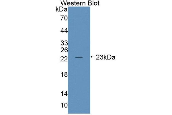 ABCA9 antibody  (AA 1423-1590)