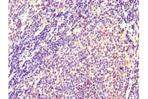 Immunohistochemistry of paraffin-embedded human lymph node tissue using ABIN7146099 at dilution of 1:100 (CXCR2 Antikörper  (AA 1-40))