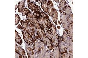 Immunohistochemical staining of human stomach with GDF6 polyclonal antibody  shows strong membranous and cytoplasmic positivity in glandular cells. (GDF6 Antikörper)