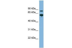 Human kidney; WB Suggested Anti-ABCF2 Antibody Titration: 0. (ABCF2 Antikörper  (N-Term))