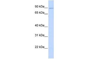 WB Suggested Anti-ZNF408 Antibody Titration:  0. (ZNF408 Antikörper  (Middle Region))