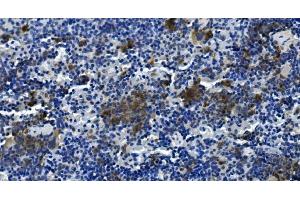 IHC analysis of Tigit using anti-Tigit antibody (ABIN7601117).