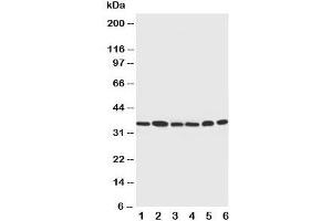 Western blot testing of Cdk4 antibody and Lane 1:  rat thymus;  2: HeLa;  3: MCF-7;  4: A549;  5: COLO320;  6: Jurkat cell lysate (CDK4 Antikörper  (C-Term))