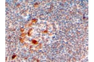 ABIN184577 (4µg/ml) staining of paraffin embedded Human Lymph Node. (ZCCHC11 Antikörper  (C-Term))