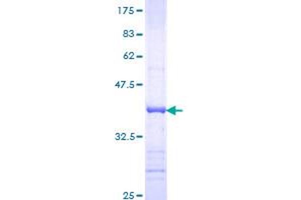 REG1A Protein (AA 67-166) (GST tag)