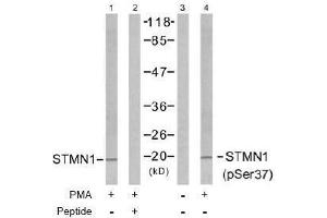 Image no. 2 for anti-Stathmin 1 (STMN1) (pSer37) antibody (ABIN196971) (Stathmin 1 Antikörper  (pSer37))