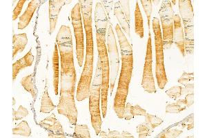 ABIN6264825 and ABIN6273015 at 1/100 staining Mouse muscle tissue by IHC-P. (RPGRIP1L Antikörper  (N-Term))