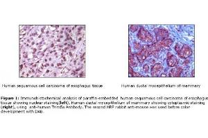 Image no. 1 for Rabbit anti-Mouse IgG antibody (HRP) (ABIN305604)
