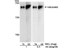 Western Blotting (WB) image for anti-Regulation of Nuclear Pre-mRNA Domain Containing 2 (RPRD2) (AA 1000-1050) antibody (ABIN7452562) (RPRD2 Antikörper  (AA 1000-1050))