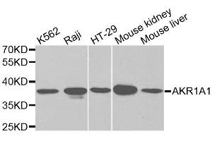 Western blot analysis of extracts of various cell lines, using AKR1A1 antibody. (AKR1A1 Antikörper  (AA 1-325))