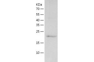Western Blotting (WB) image for RAP1A, Member of RAS Oncogene Family (RAP1A) (AA 1-181) protein (His tag) (ABIN7286723) (RAP1A Protein (AA 1-181) (His tag))