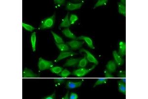 Immunofluorescence analysis of U2OS cells using GAMT Polyclonal Antibody (GAMT Antikörper)