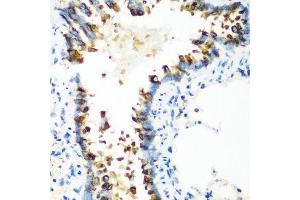 Immunohistochemistry of paraffin-embedded rat lung using MT-CO2 antibody.