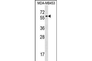 FSD1 Antibody (N-term) (ABIN1539659 and ABIN2848768) western blot analysis in MDA-M cell line lysates (35 μg/lane).