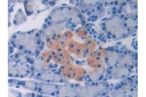 Immunohistochemistry (IHC) image for anti-Transforming Growth Factor, beta 2 (TGFB2) (AA 331-442) antibody (ABIN7429460)