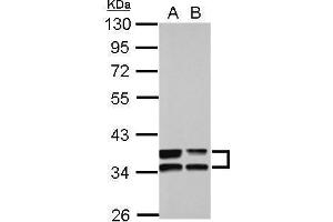 WB Image Sample (30 ug of whole cell lysate) A: A549 B: HCT116 10% SDS PAGE antibody diluted at 1:10000 (Annexin A3 Antikörper)