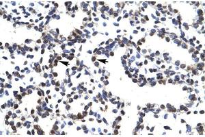 Human Lung; LHX3 antibody - middle region in Human Lung cells using Immunohistochemistry