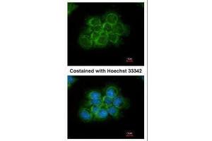 ICC/IF Image Immunofluorescence analysis of methanol-fixed A431, using CRK, antibody at 1:200 dilution. (Crk Antikörper  (Center))