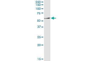 SLC11A1 monoclonal antibody (M01), clone 2G2. (SLC11A1 Antikörper  (AA 308-350))