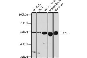 Western blot analysis of extracts of various cell lines, using EY Rabbit pAb (ABIN6135167, ABIN6140386, ABIN6225031 and ABIN6225033) at 1:1000 dilution. (EYA1 Antikörper  (AA 100-250))