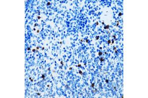 Immunohistochemistry of paraffin-embedded mouse spleen using SPN antibody (ABIN5973813) at dilution of 1/100 (40x lens). (CD43 Antikörper)