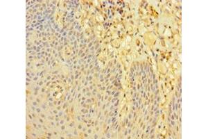 Immunohistochemistry of paraffin-embedded human tonsil tissue using ABIN7168070 at dilution of 1:100