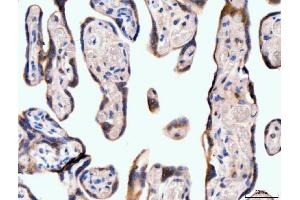 IHC analysis of Neurofibromin/NF1 using anti-Neurofibromin/NF1 antibody (ABIN7600197). (Neurofibromin 1 Antikörper  (AA 160-270))