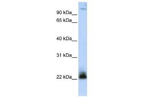 WB Suggested Anti-ITGB3BP Antibody Titration: 0. (ITGB3BP Antikörper  (N-Term))