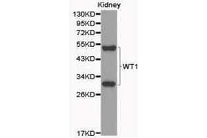 Western Blotting (WB) image for anti-Wilms Tumor 1 (WT1) antibody (ABIN1875356) (WT1 Antikörper)