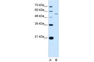KCNQ2 antibody used at 0. (KCNQ2 Antikörper  (N-Term))