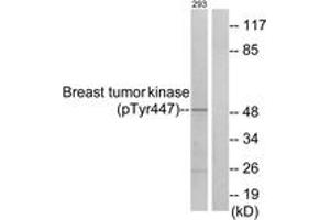 Western blot analysis of extracts from 293 cells treated with EGF 200ng/ml 30', using Breast Tumor Kinase (Phospho-Tyr447) Antibody. (PTK6 Antikörper  (pTyr447))