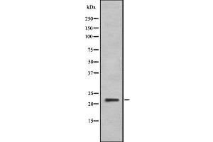 Western blot analysis IFNA6 using HeLa whole cell lysates (IFNA6 Antikörper  (C-Term))