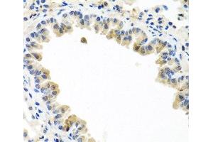 Immunohistochemistry of paraffin-embedded Mouse lung using BMP5 Polyclonal Antibody at dilution of 1:100 (40x lens). (BMP5 Antikörper)