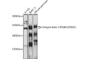 Western blot analysis of extracts of various cells, using Integrin beta 4 (ITGB4/CD104) antibody (ABIN1680489, ABIN3015361, ABIN3015362 and ABIN6214007) at 1:1000 dilution. (Integrin beta 4 Antikörper  (AA 28-310))