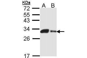 WB Image Sample (30 ug of whole cell lysate) A: 293T B: A431 , 12% SDS PAGE antibody diluted at 1:1000 (CA2 Antikörper)